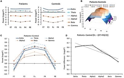 Right Frontal Theta: Is It a Response Biomarker for Ketamine’s Therapeutic Action in Anxiety Disorders?